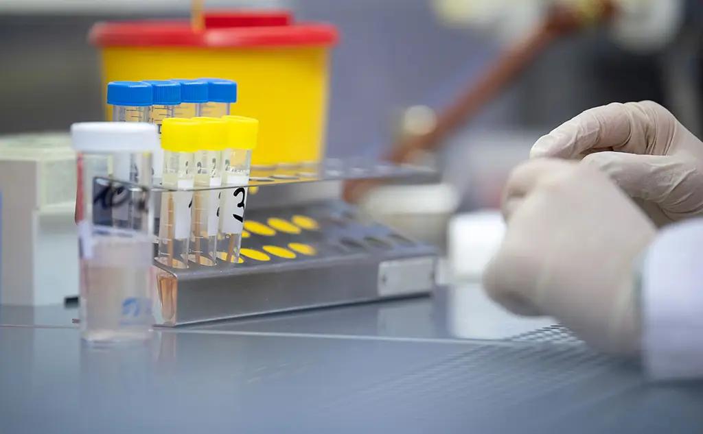 КР закупит 30 тысяч экспресс-тестов из Китая