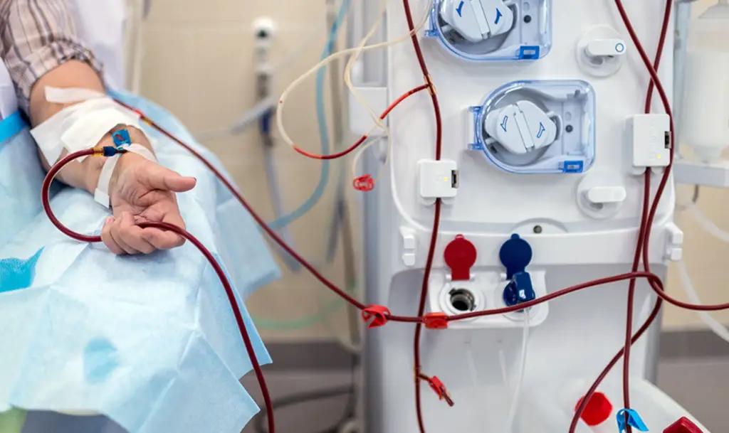 Делать операции вместо гемодиализа предложили в КР