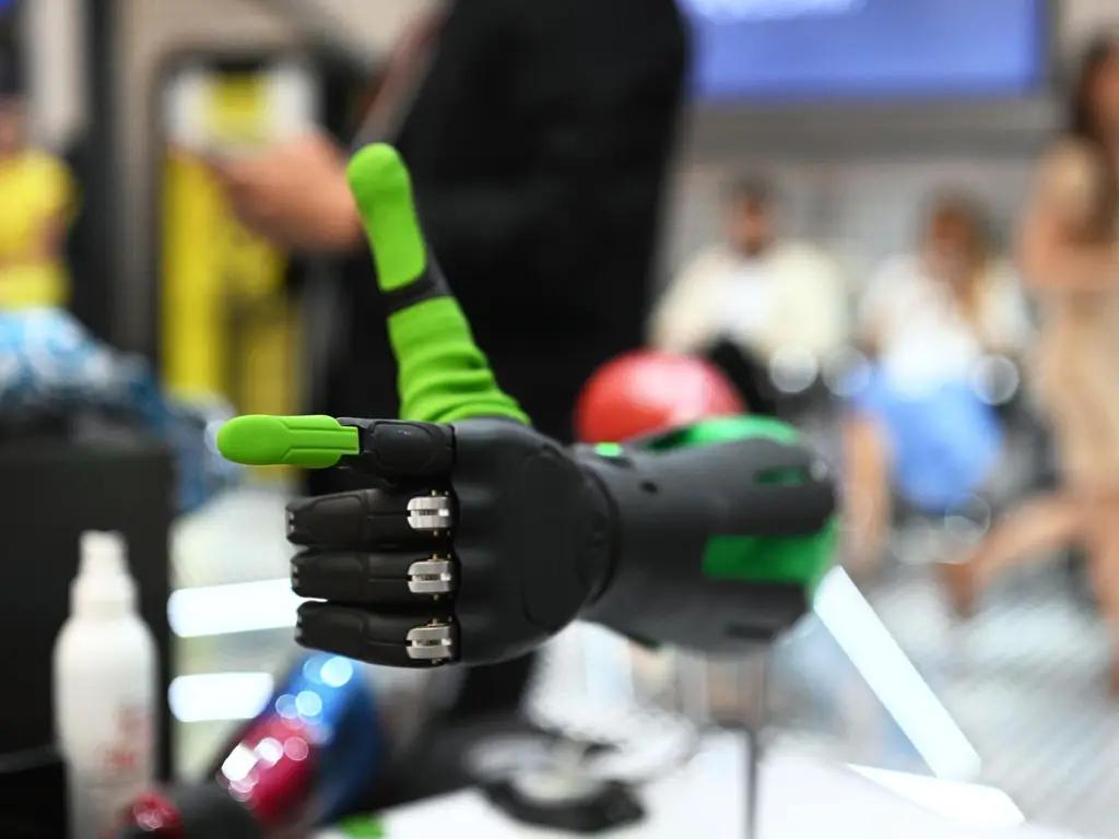 В 2023 году 13 детям изготовили протезы рук на общую сумму 1.8 млн сомов