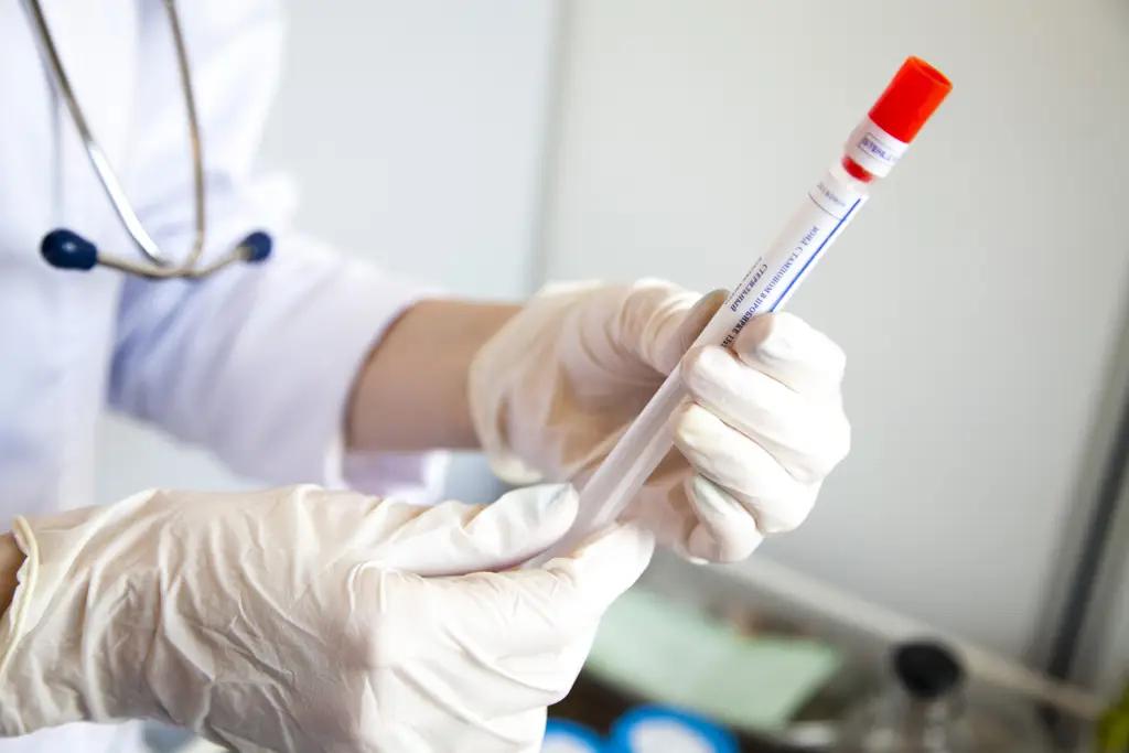 В «Оптима Банке» у нескольких сотрудников выявили коронавирус