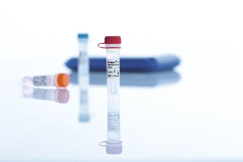 Кыргызстан получил 84 набора тест-систем для ПЦР из КНР