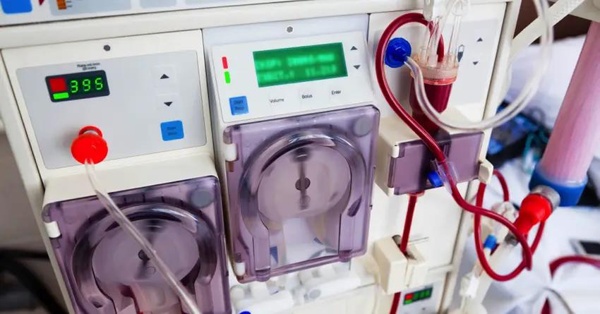 Гемодиализ станет доступнее в Кыргызстане благодаря первому проекту ГЧП