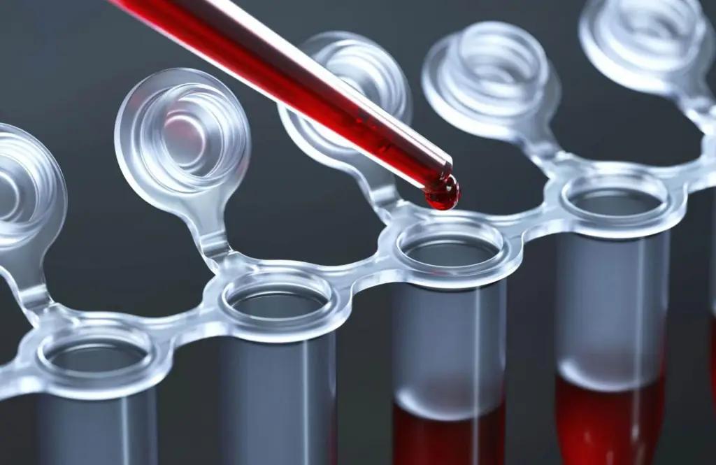 Для НЦО закупят лабораторные реактивы и медицинские изделия на 8.2 млн сомов