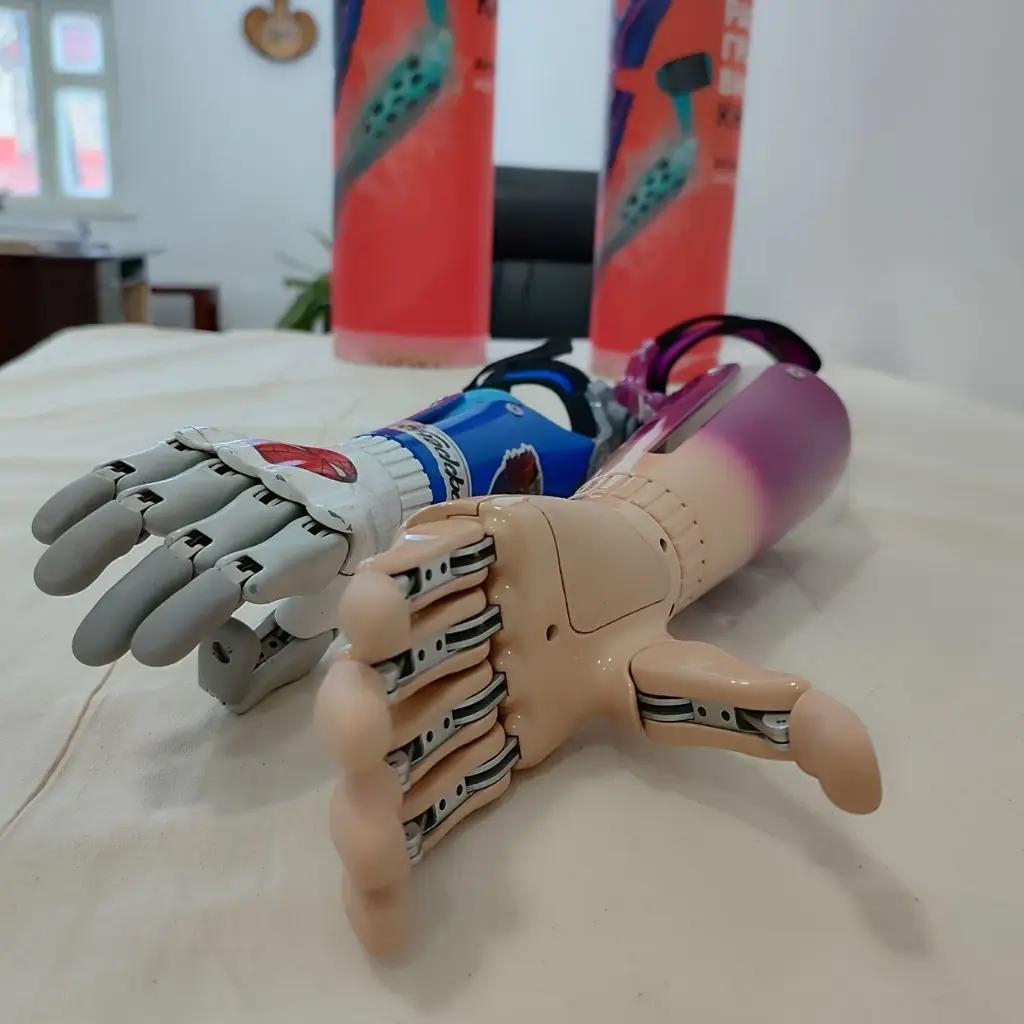 В 2025 году республиканскому протезно-ортопедическому учреждению выделили 123 млн сомов