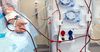 ФОМС перезаключил договор с 34 частными клиниками на гемодиализ