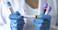 Всемирный банк готов помочь КР в профилактике коронавируса